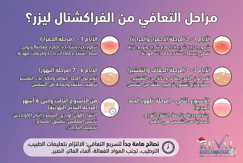 ما هي مراحل التعافي من الفراكشنال ليزر؟
