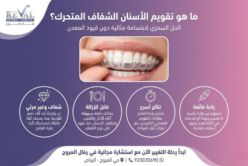 ما هو تقويم الأسنان الشفاف المتحرك؟