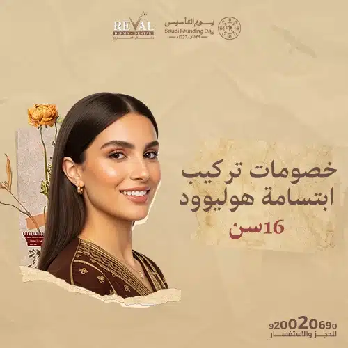 خطوات تركيب ابتسامة هوليوود