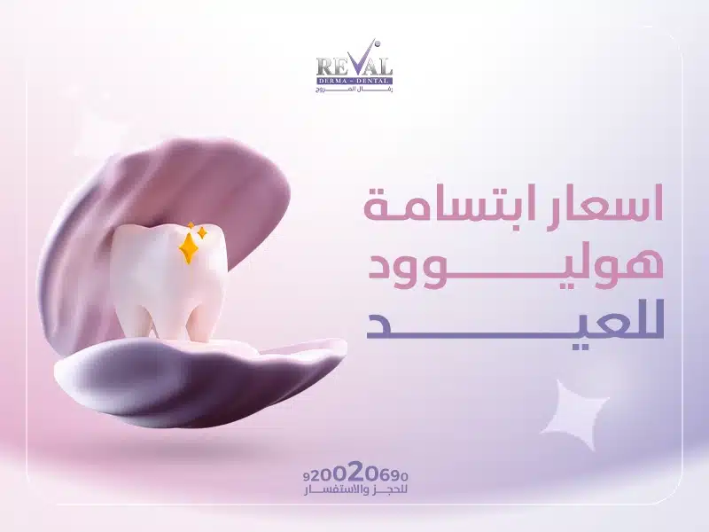عروض ابتسامة هوليوود (16 سن)