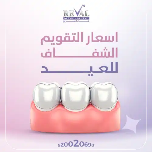 تكلفة التقويم الشفاف