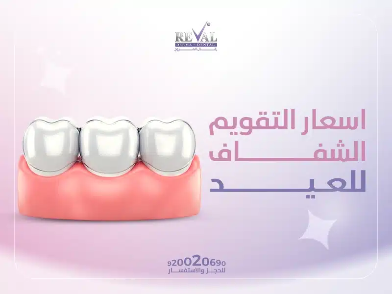 أفضل أسعار التقويم الشفاف للعيد في المملكة؟