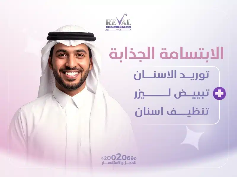 أفضل اسعار الابتسامة الجذابة للعيد في الرياض 2026