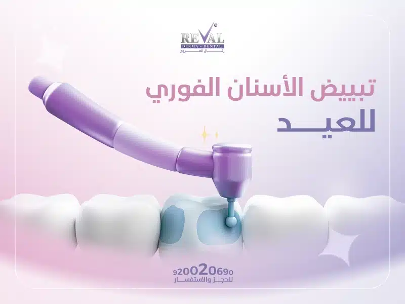 تبييض الأسنان الفوري للعيد: اسعار جلسات التبييض الفوري للاسنان بالرياض