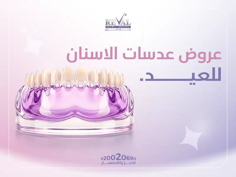 عروض عدسات الأسنان للعيد: ابتسامة نجوم هوليوود بين يديك