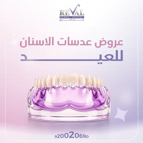 عروض عدسات الأسنان للعيد