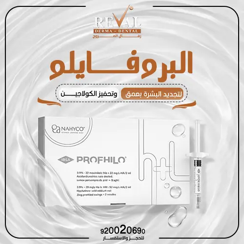 كم تدوم نتائج حقن البروفايلو؟