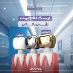 تركيبات الأسنان: ابتسامتك المثالية تبدأ مع رفال المروج 