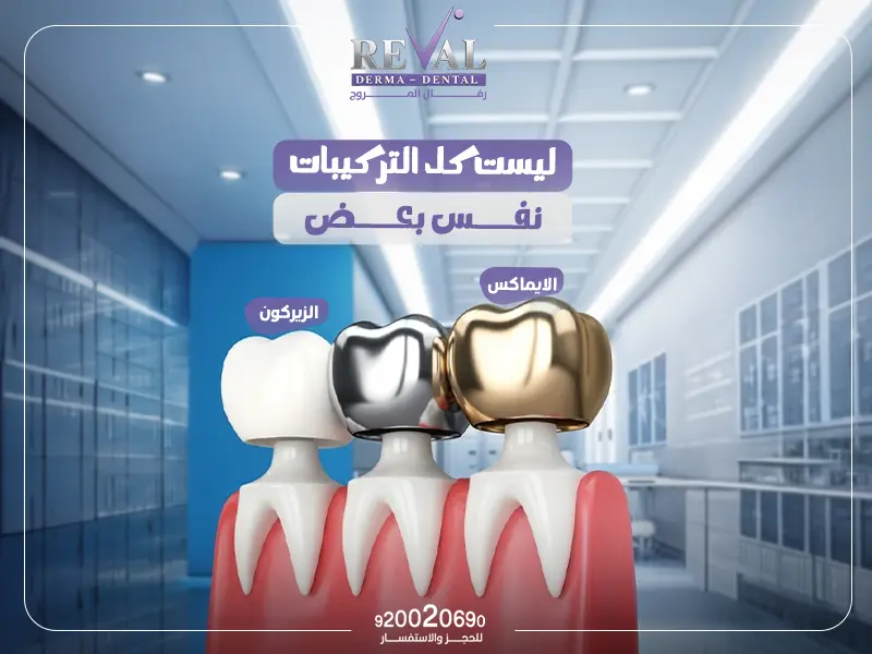 تركيبات الأسنان: ابتسامتك المثالية تبدأ مع رفال المروج 