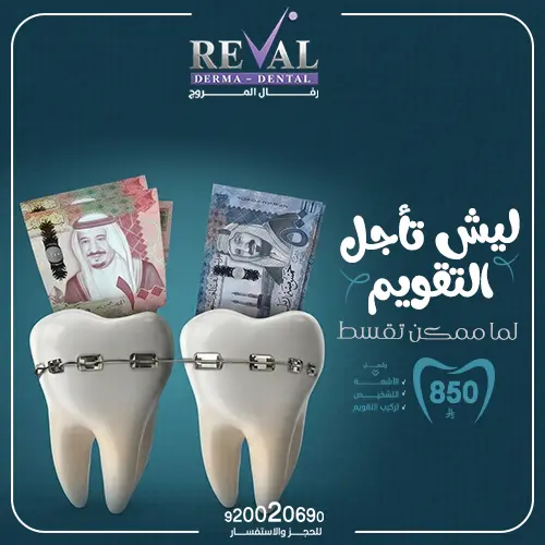 تجربتي -مع- تقويم- الأسنان