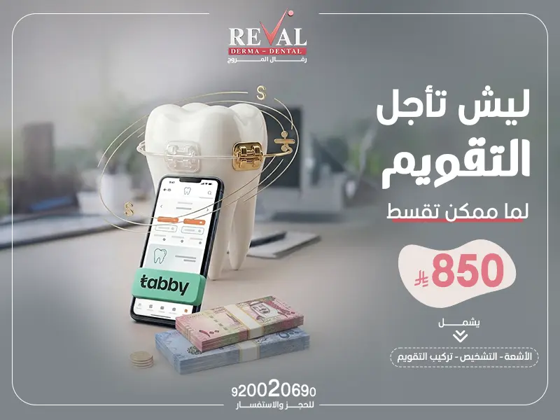 تقويم الأسنان: الأنواع، المدة، النتائج ونصائح قبل وبعد تركيب التقويم بالمروج