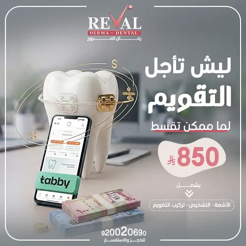 أنواع تقويم الأسنان المختلفة