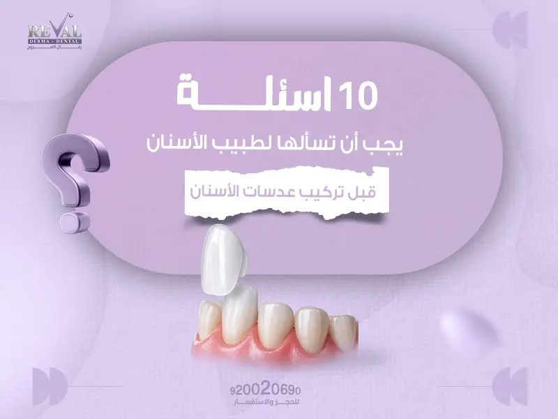 أسئلة يجب أن تسألها لطبيب الأسنان قبل تركيب عدسات الأسنان