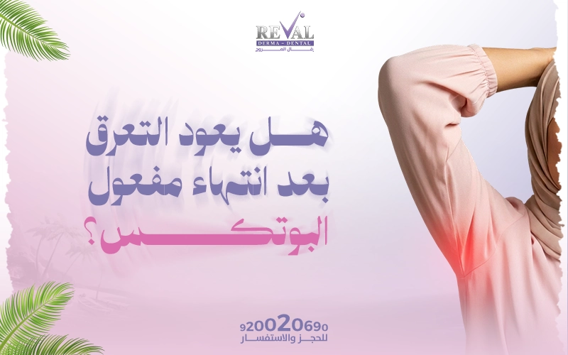 هل يعود التعرق بعد انتهاء مفعول البوتكس؟