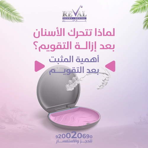 أنواع مثبتات الأسنان بعد التقويم: أيهما يناسبك؟