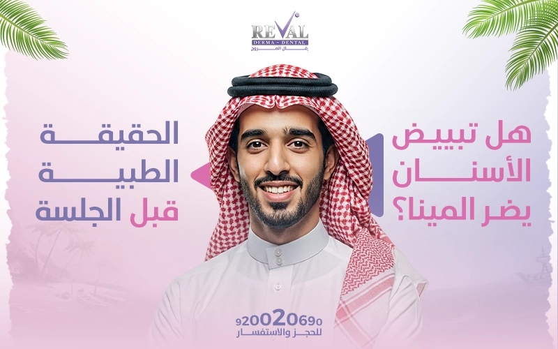هل تبييض الأسنان يضر المينا؟