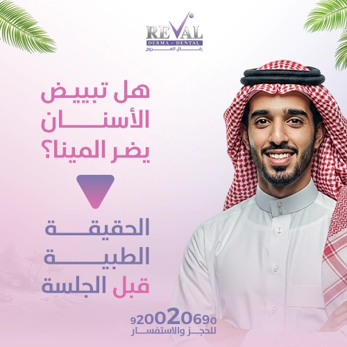 ما هي مدة بقاء نتائج تبييض الاسنان وهل تحتاج إلى جلسات متكررة؟