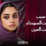 سبب الهالات السوداء تحت العين