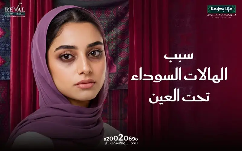 سبب الهالات السوداء تحت العين