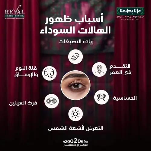 أسباب ظهور الهالات السوداء
