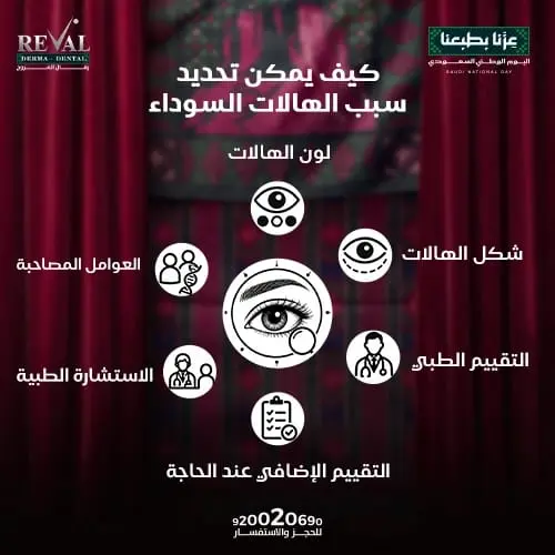 أنواع الهالات السوداء تحت العين