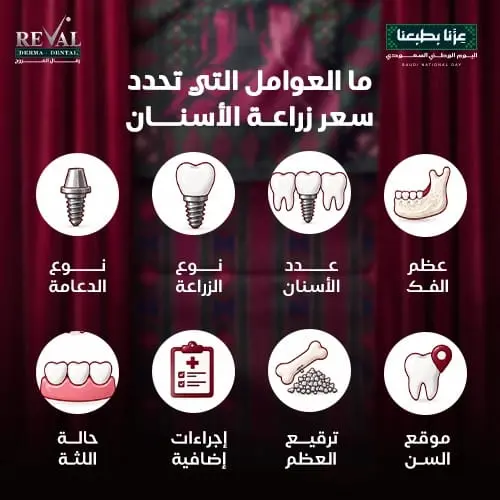 العوامل التي تحدد سعر زراعة الاسنان