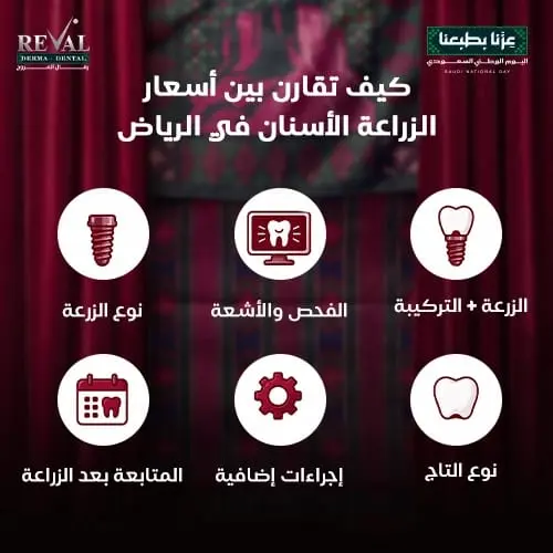 مقارنة سعر زراعة الاسنان في الرياض