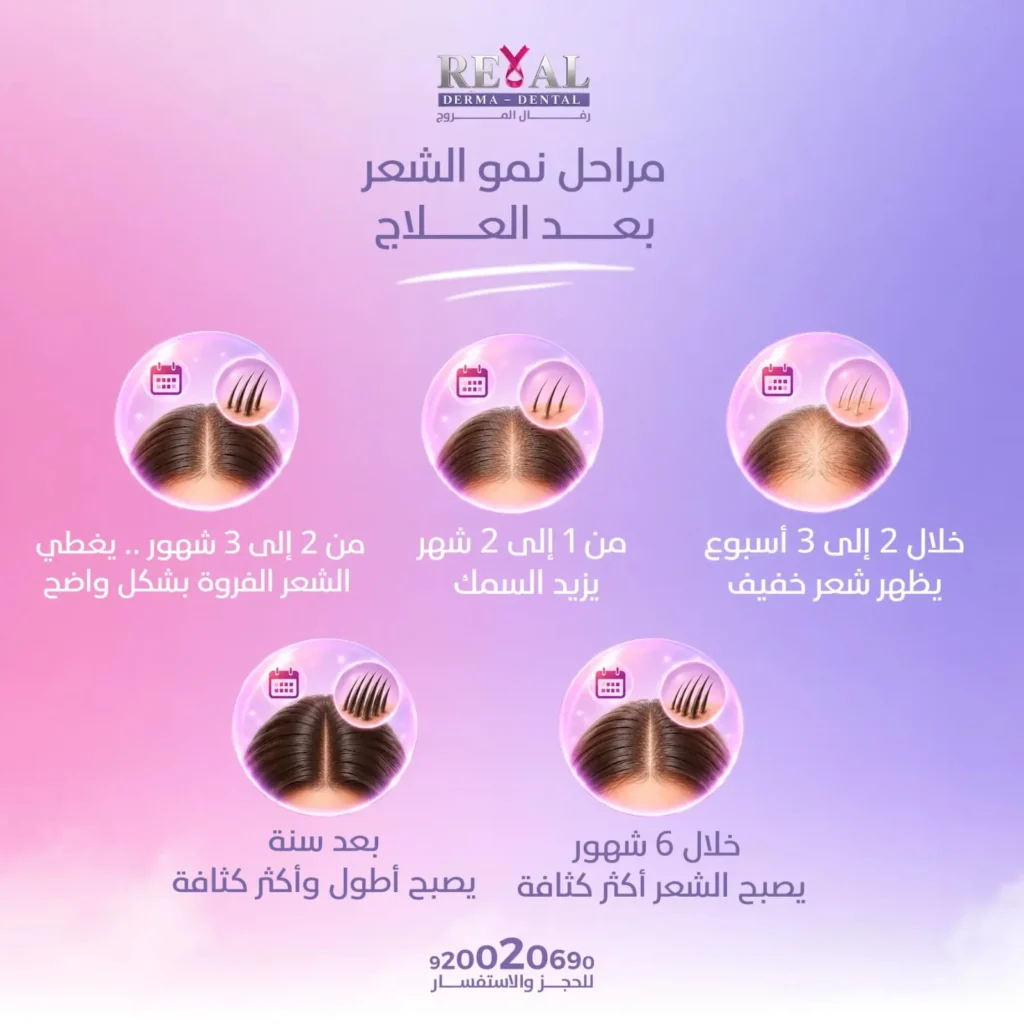 مراحل نمو الشعر بعد العلاج الكيماوي