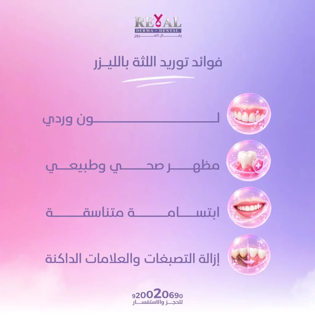 فوائد توريد اللثة بالليزر