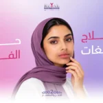 علاج التصبغات حول الفم