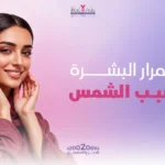 اسمرار البشرة بسبب الشمس