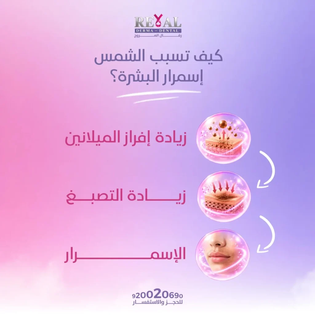 كيف يحدث اسمرار البشرة بسبب الشمس