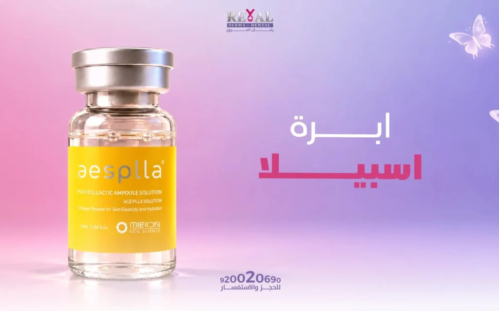 ابرة اسبيلا