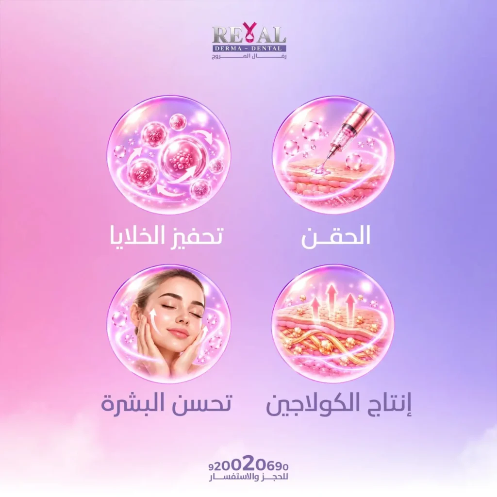كيف تعمل ابرة اسبيلا